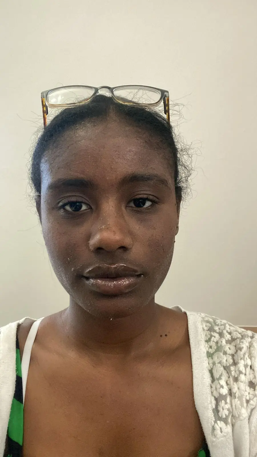 Before Facial Transformation