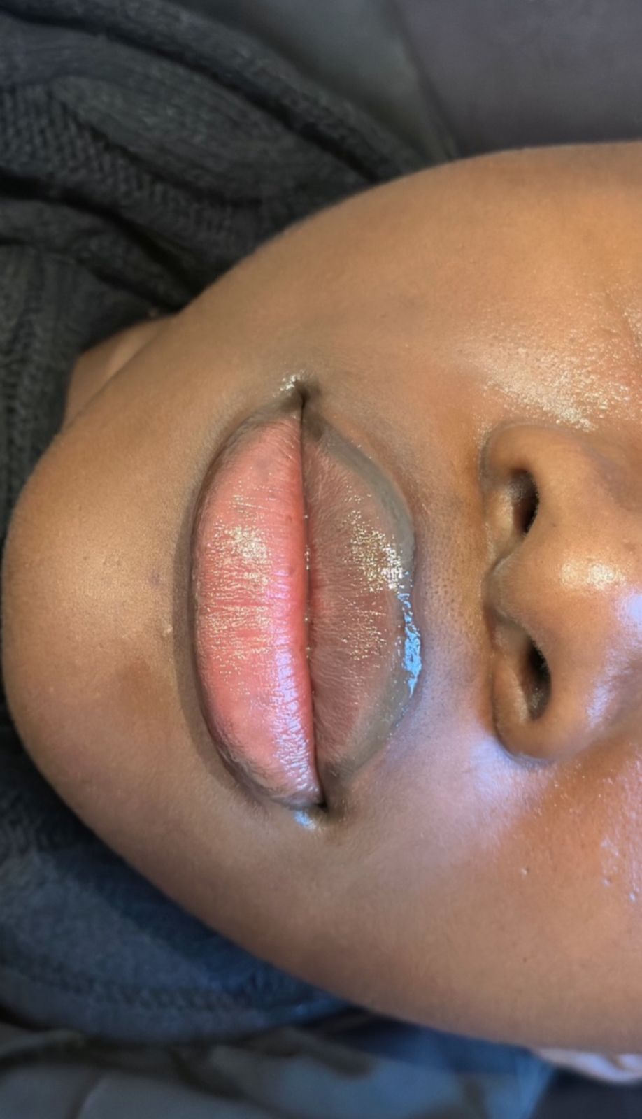After Semi-Permanent Lip Liner