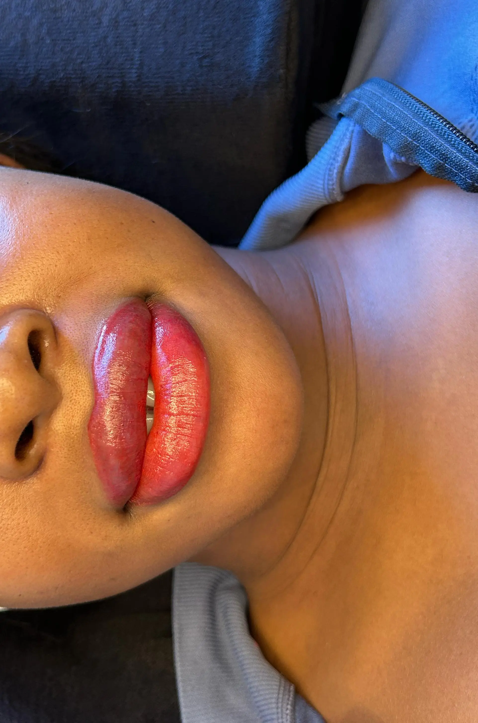 After Semi-Permanent Lip Blush